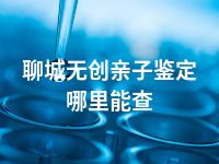 聊城无创亲子鉴定哪里能查