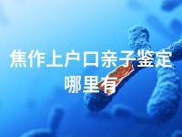 焦作上户口亲子鉴定哪里有