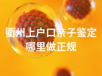衢州上户口亲子鉴定哪里做正规
