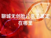 聊城无创胎儿亲子鉴定在哪里