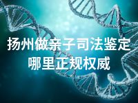 扬州做亲子司法鉴定哪里正规权威