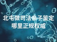 北屯做司法亲子鉴定哪里正规权威