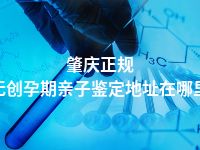 肇庆正规无创孕期亲子鉴定地址在哪里