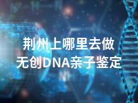 荆州上哪里去做无创DNA亲子鉴定