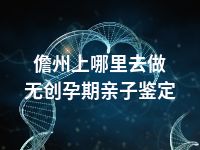 儋州上哪里去做无创孕期亲子鉴定
