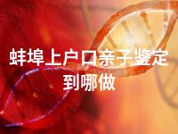 蚌埠上户口亲子鉴定到哪做