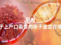 荆州孩子上户口需要的亲子鉴定在哪做